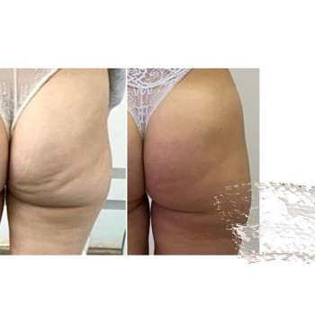 Евгения Ряпосова , Moscow Фото - 6