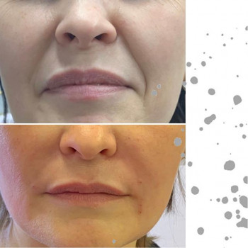 Евгения Ряпосова , Moscow Фото - 7