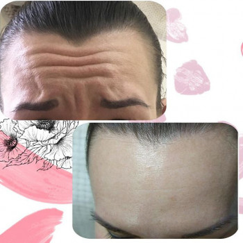 Маргарита Лемм , Moscow Фото - 6