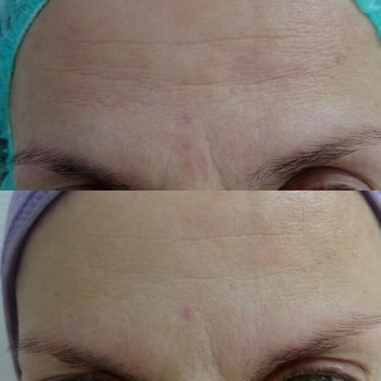 Юлия Элькина , Moscow Фото - 5