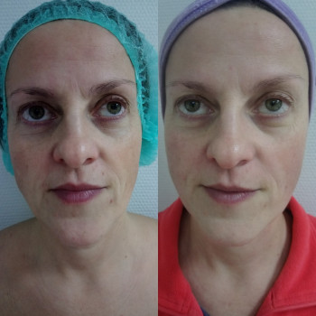 Юлия Элькина , Moscow Фото - 6