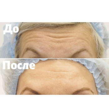 Медпрайм, Москва Фото - 5