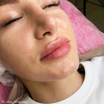 SkinLaser, Moscow Фото - 5