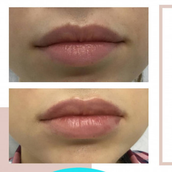 Lips Clinic, Moscow Фото - 5