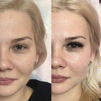 Наталия Филатова , Moscow Фото - 5