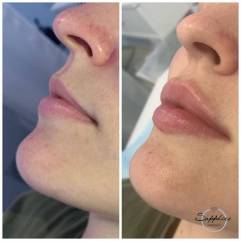 Sapphire, Moscow Фото - 5