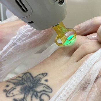 Laser ABSalute, Moscow Фото - 5