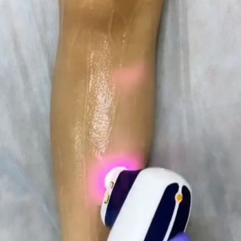 Лазерная эпиляция ног полностью / жен