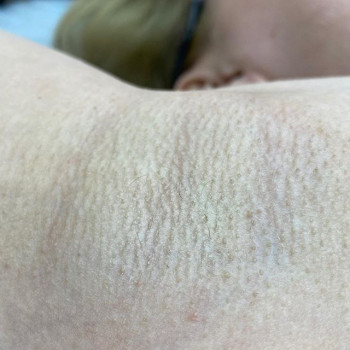 Epil Time, Moscow Фото - 5