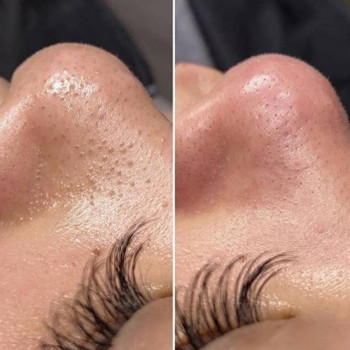 Ti Golden Beauty, Moscow Фото - 6