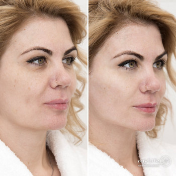 RayLife, Moscow Фото - 5