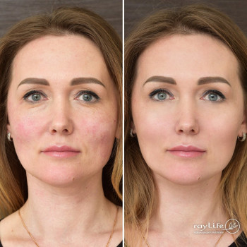 RayLife, Moscow Фото - 6