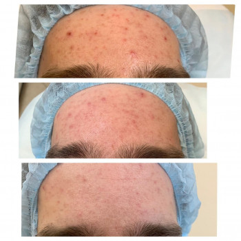 Клиника Академической Косметологии, Москва Фото - 6