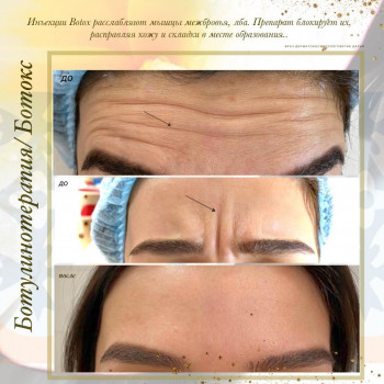 EMS, Москва Фото - 6