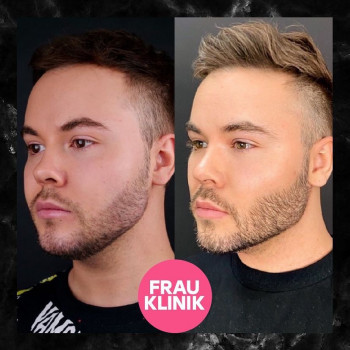 Фрау Клиник, Moscow Фото - 6