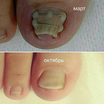 Наталья Пармузина , Moscow Фото - 6