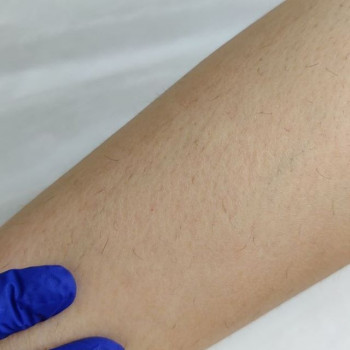 Effect Epil, Moscow Фото - 6