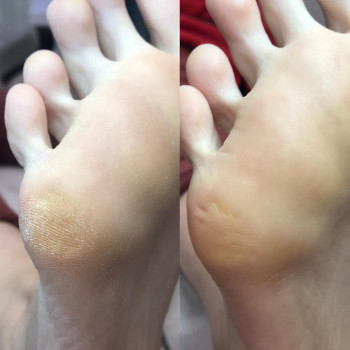 Инна Яремчук , Москва Фото - 6