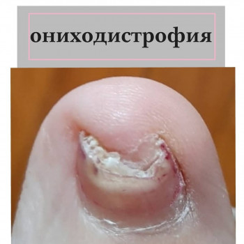 Оксана Лысенко , Москва Фото - 6