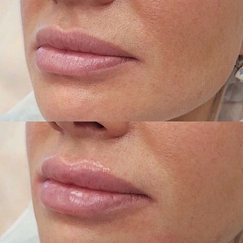 Pro Visage, Saint Petersburg Фото - 11