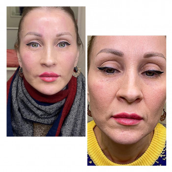 Стелла Саргиси , Moscow Фото - 5