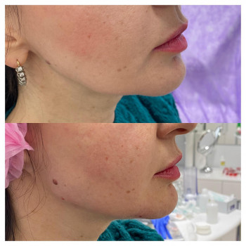 Загидат Куччаева , Москва Фото - 5