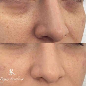 Регина Санакоева , Москва Фото - 5