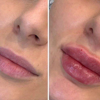 Нелли Едзаева , Moscow Фото - 5