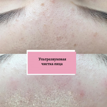 Анна Усова , Москва Фото - 5