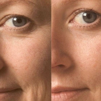 Благодатная, Saint Petersburg Фото - 5