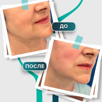 Total Charm, Saint Petersburg Фото - 15