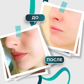 Total Charm, Saint Petersburg Фото - 16