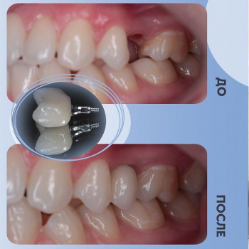 Доктор ДЕНТ, Saint Petersburg Фото - 8