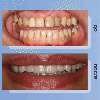 Доктор ДЕНТ, Saint Petersburg Фото - 9