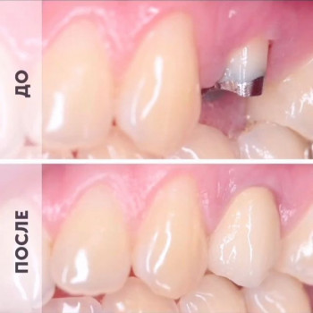 Доктор ДЕНТ, Saint Petersburg Фото - 11