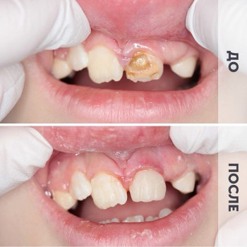 Доктор ДЕНТ, Saint Petersburg Фото - 12