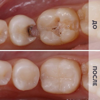 Доктор ДЕНТ, Saint Petersburg Фото - 13