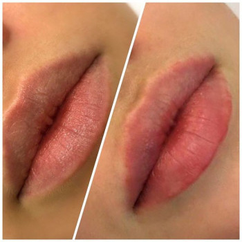 Таурас-МЕД, Saint Petersburg Фото - 6