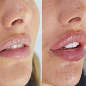 Елена Мирай, Saint Petersburg Фото - 5