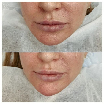 Наталия Рыжих , Moscow Фото - 5