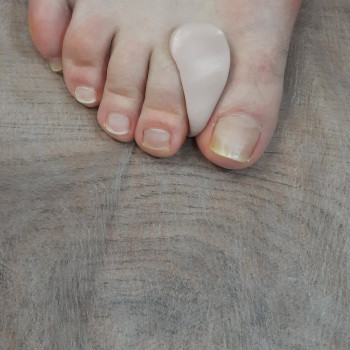 Снятие гель-лака с ногтей на ногах