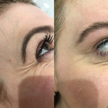 Анна Келип-Настаченко, Moscow Фото - 5