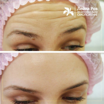 Лейла Роз, Moscow Фото - 5