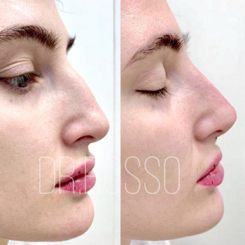 Наталия Россо, Москва Фото - 5