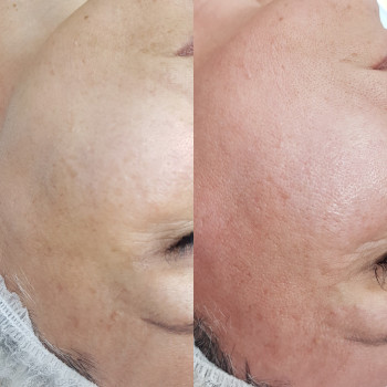 Ирина Плехун, Moscow Фото - 5