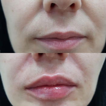 Ирина Плехун, Moscow Фото - 6