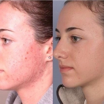 Елена Исаева, Moscow Фото - 5