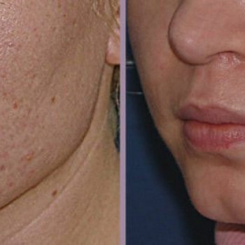 Ольга Дахина, Moscow Фото - 5