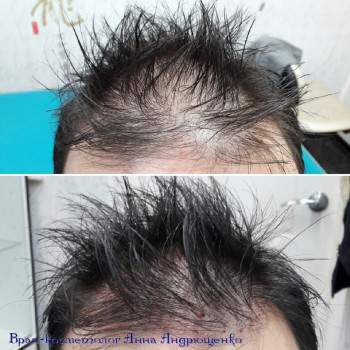 Анна Андрющенко, Moscow Фото - 5