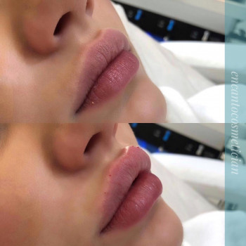 Элина Дормидошина, Moscow Фото - 5